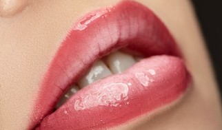 lip fillers