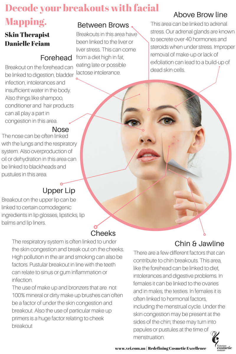 Face Mapping What Do Your Breakouts Actually Mean Fac - vrogue.co
