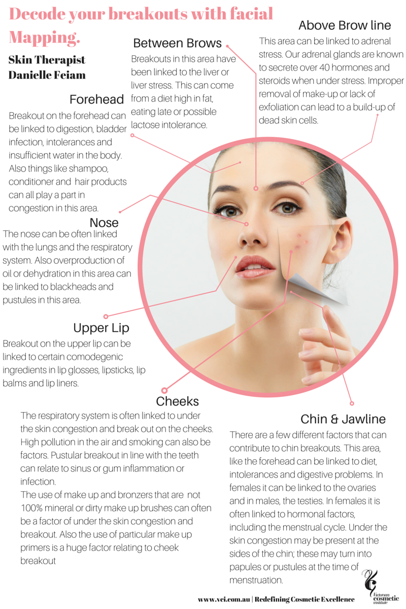 Chinese Face Chart For Acne