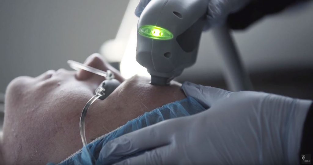 TheraClear Treatment in Progress