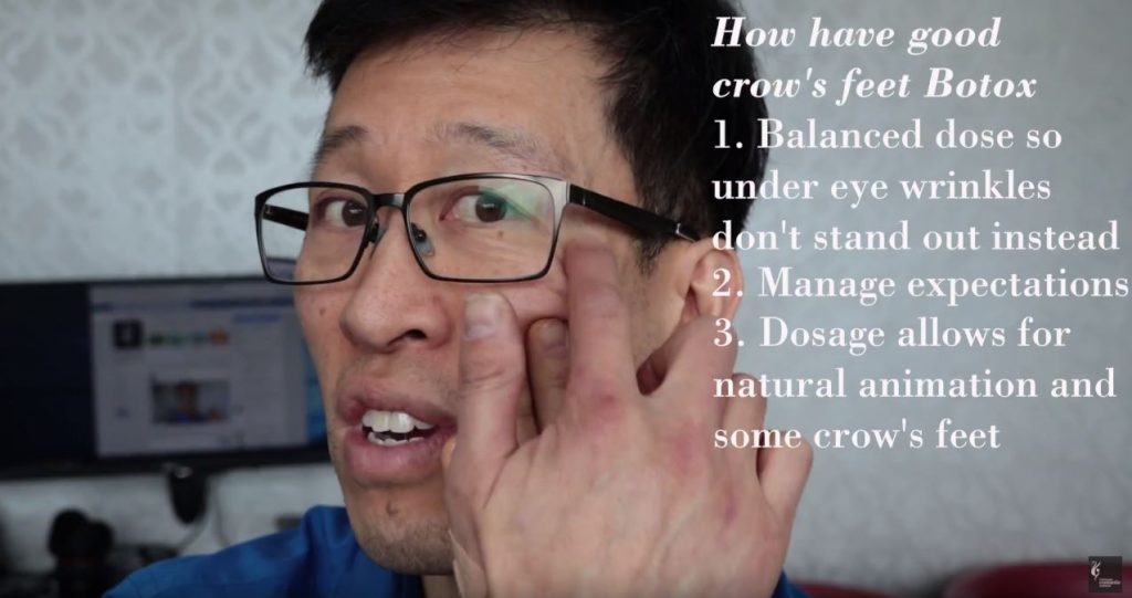 How to have good crows feet botox Dr Gavin Explains