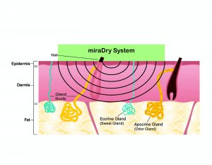 mirDry system diagram