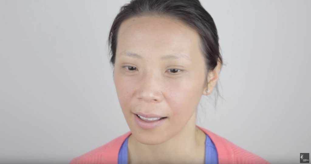 Asian laser freckle treatment post procedure