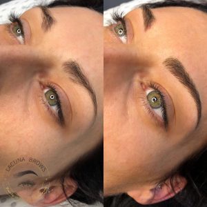 Eyebrow Tattooing - Victorian Cosmetic Institute