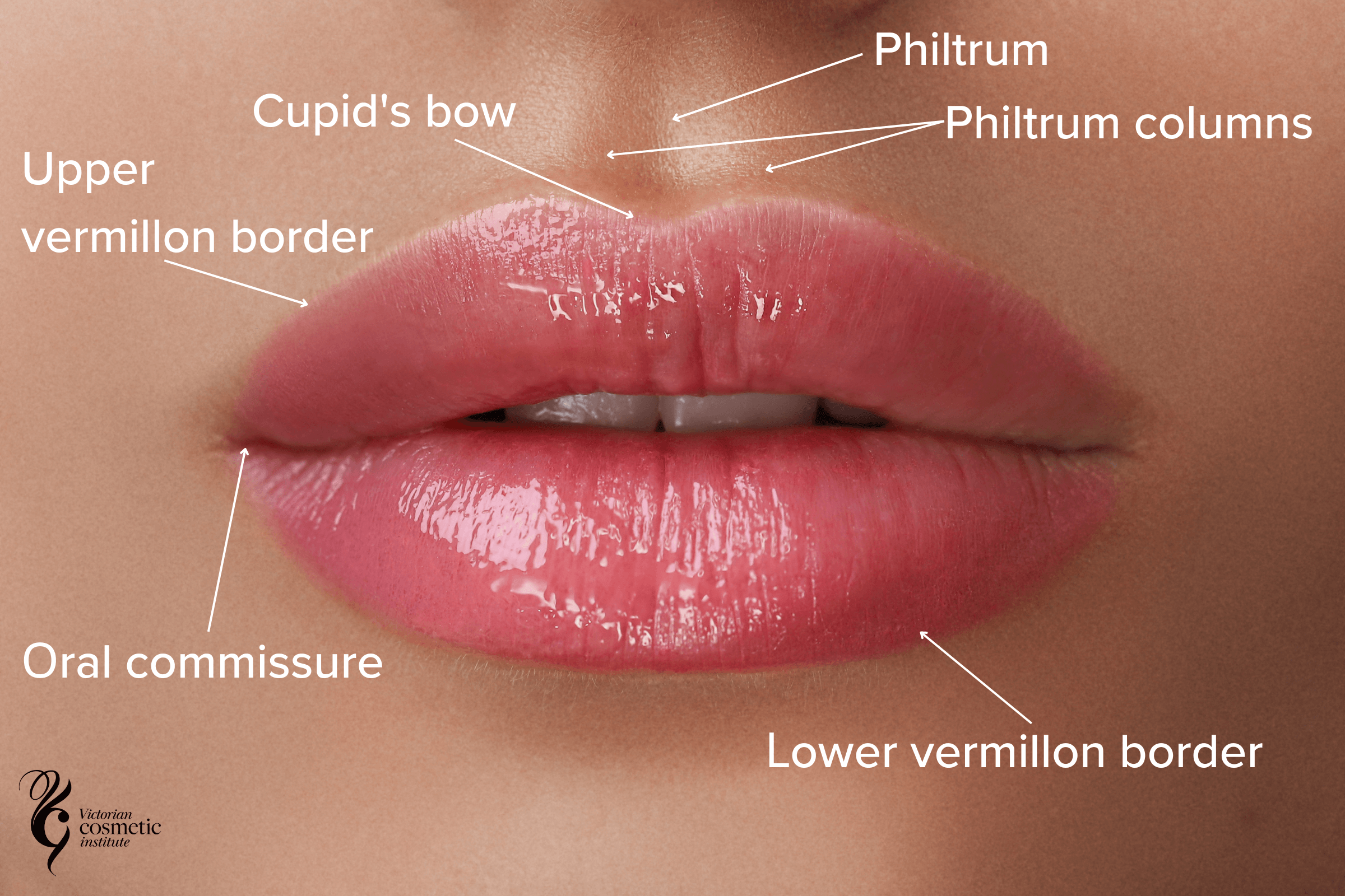 lip filler anatomy