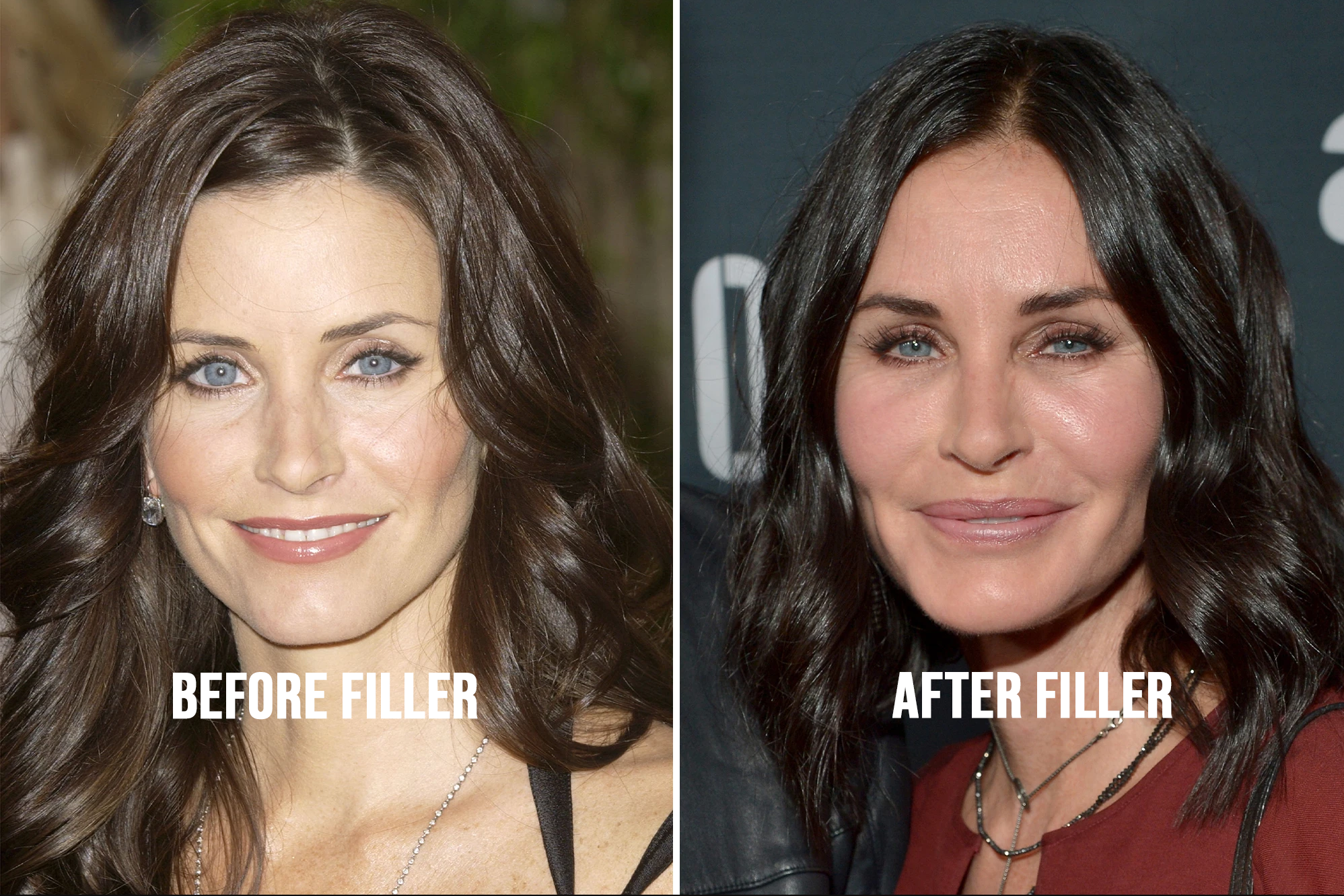 courtney cox before and after filler