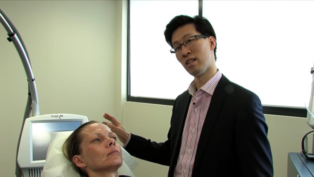 can laser remove pigmentation