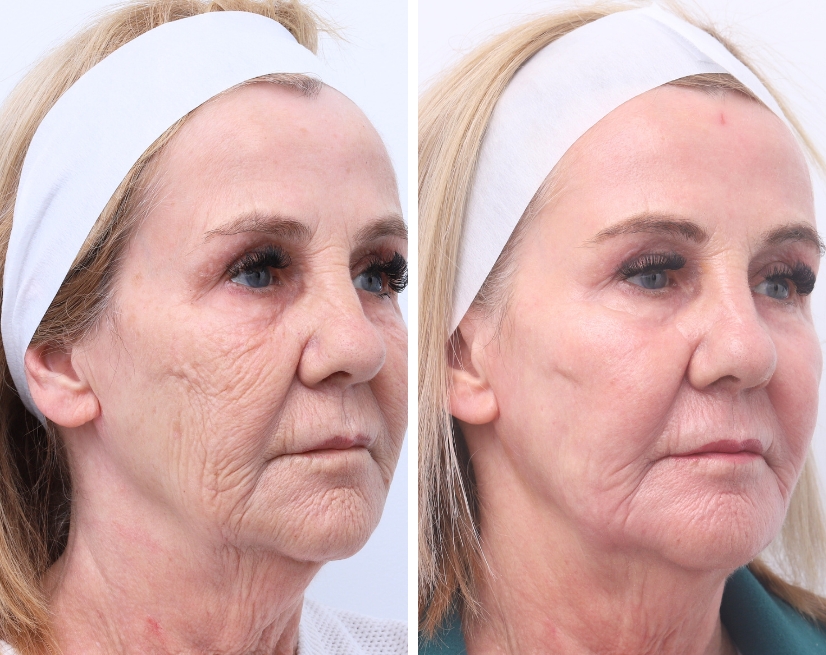 Co2 our philosophy melbourne cosmetic clinic