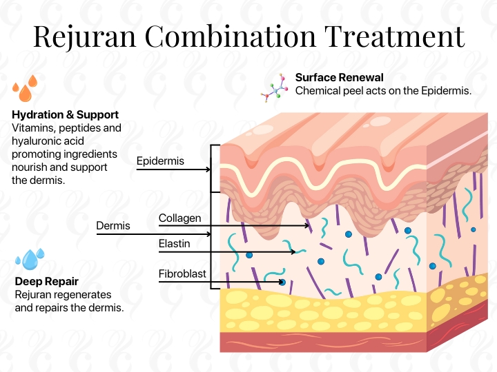 rejuran skin booster treatment melbourne