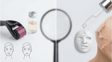 Microneedling vs. Chemical Peels: Know What To Choose For Your Skin Type